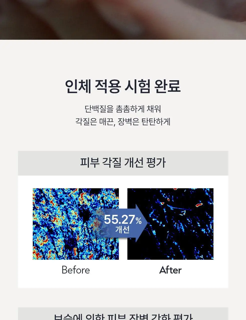 [단독구성/보습세트] 오브제 모이스처 프로틴 토너/크림 2종 기획 상세페이지 23